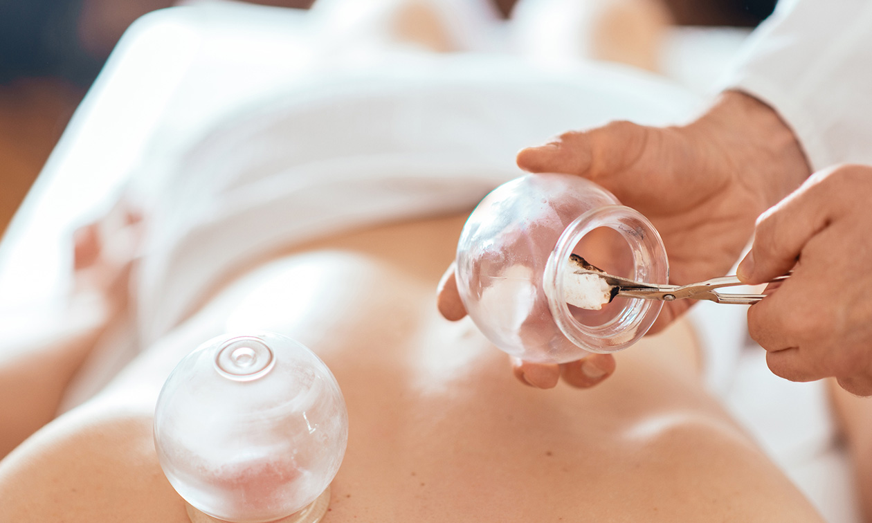 Hijama en Cupping Kliniek