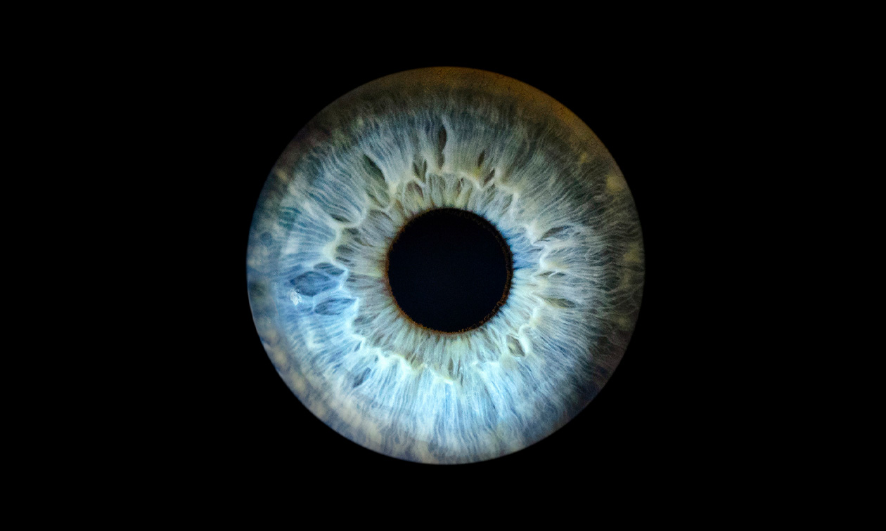 IdealEye