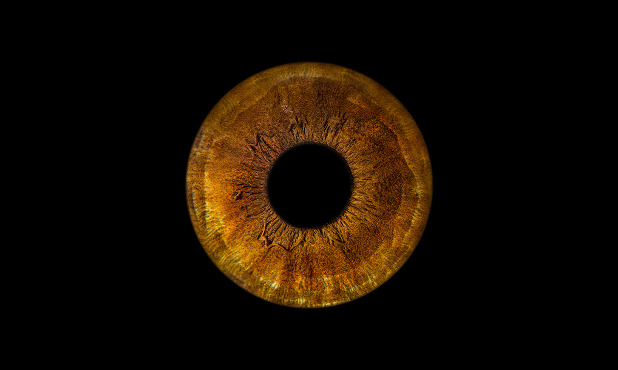 IdealEye