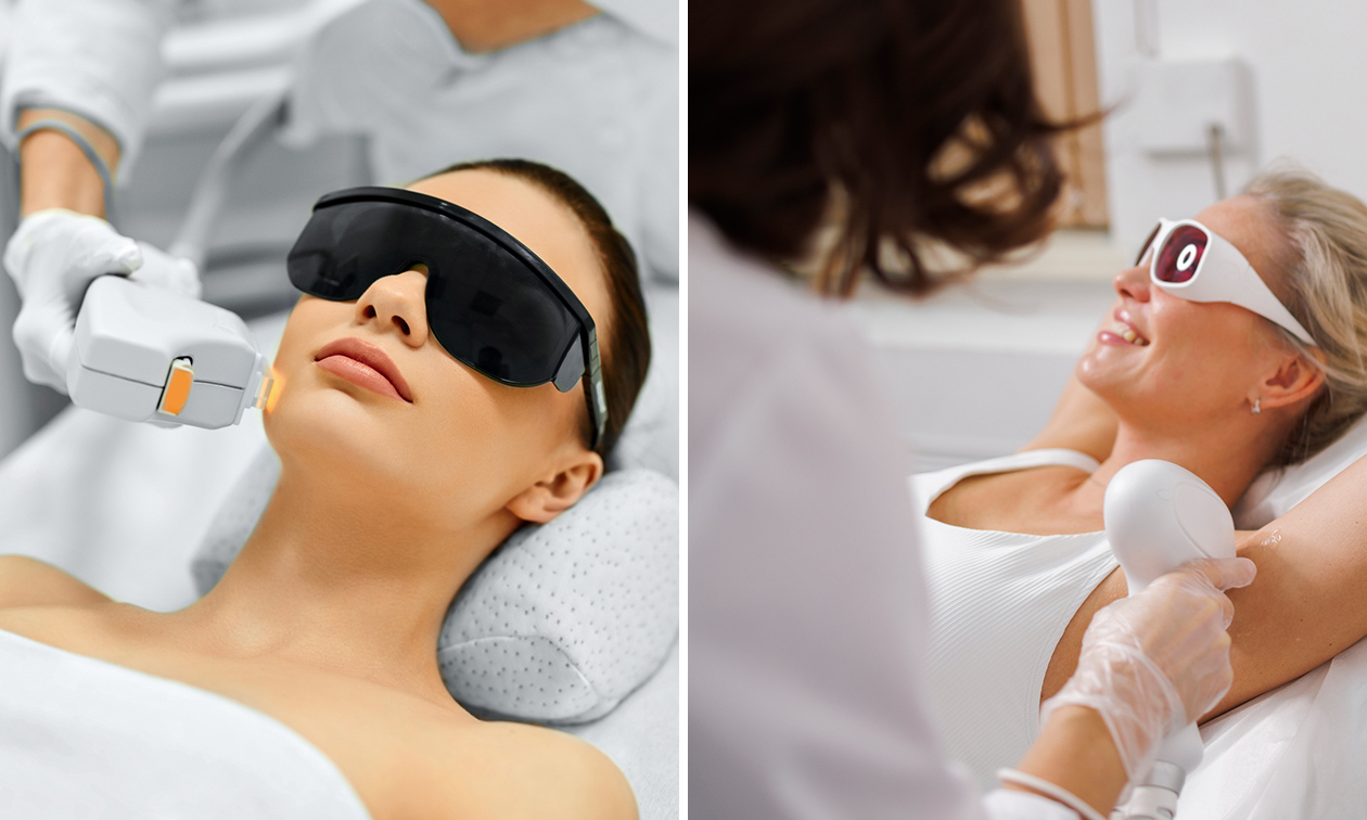 NUDE - Epilation Laser
