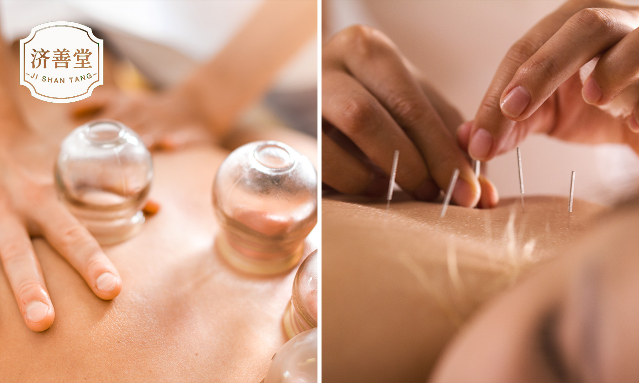 Intake + cupping, acupunctuur en/of kruidenbehandeling (30-90 min)