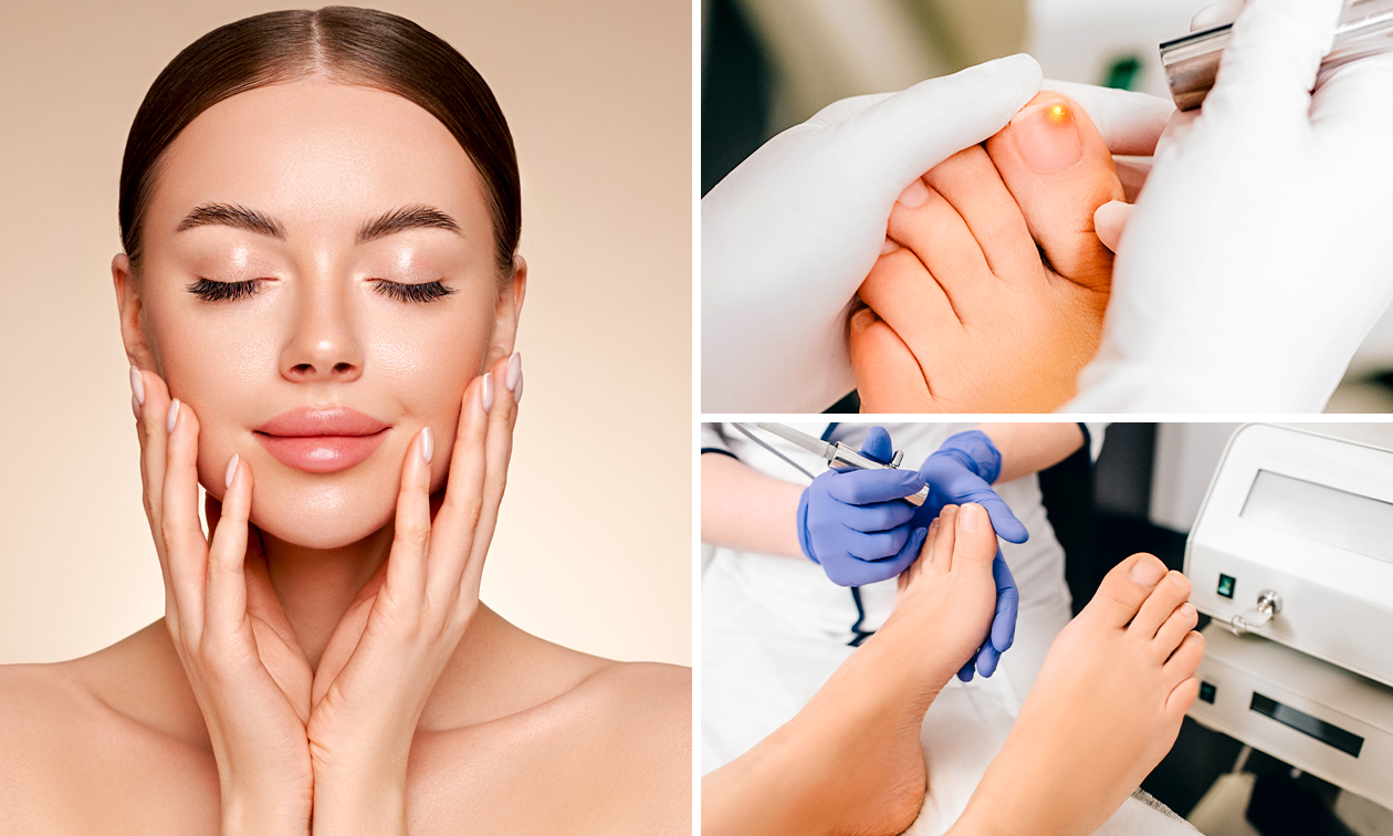 HIFU 25D Pro Max-faceliftbehandeling of 1 of 3 kalknagelbehandelingen
